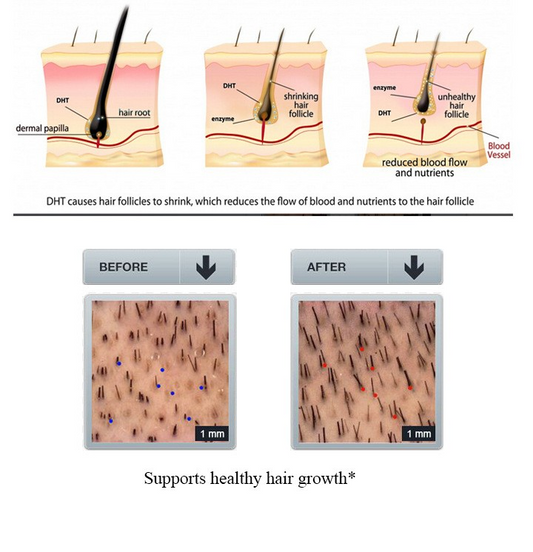 GingerGrow™ Professional Hair Care Kit